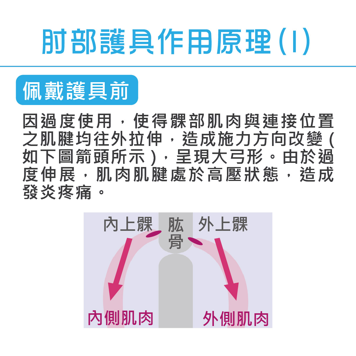護肘的作用